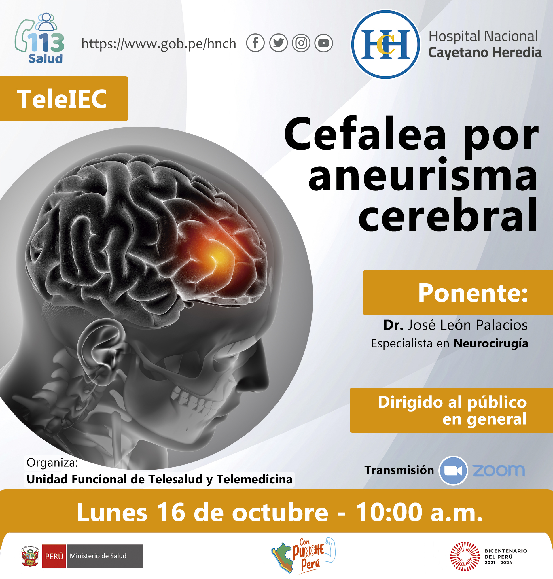 Cefalea por aneurisma cerebral