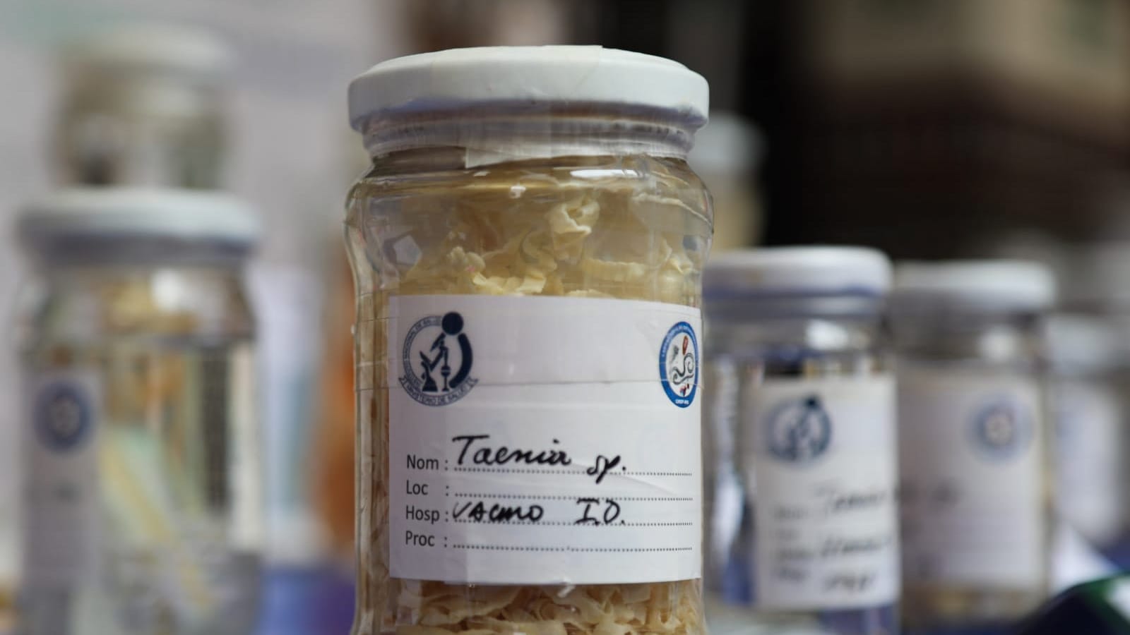 Minsa advierte que el 90% de parásitos se transmiten por el consumo de alimentos y bebidas contaminadas