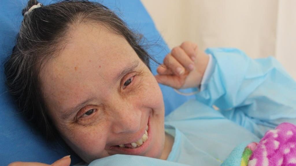 Una mujer de 47 años con síndrome de Down dejó el Hospital Emergencia Ate Vitarte (HEAV) tras superar la COVID-19.