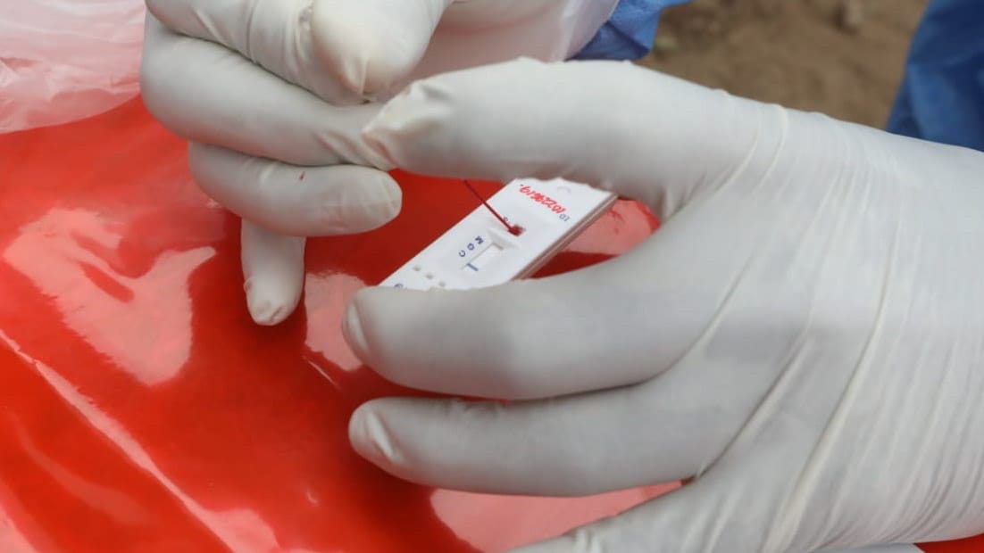 Minsa precisa uso y utilidad de pruebas serológicas y moleculares