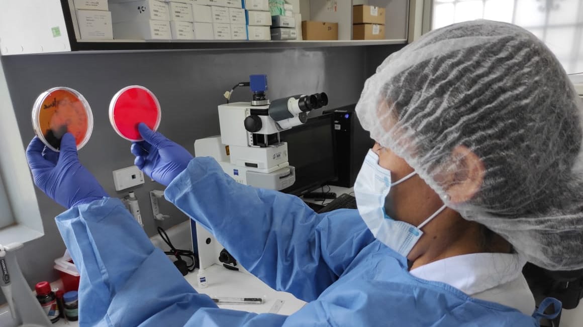 INS utiliza alta tecnología para el diagnóstico de la difteria en el país