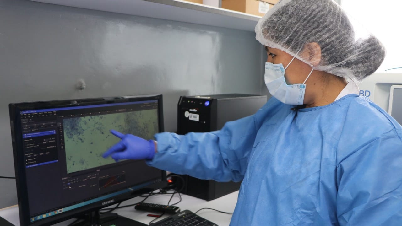 INS utiliza alta tecnología para el diagnóstico de la difteria en el país