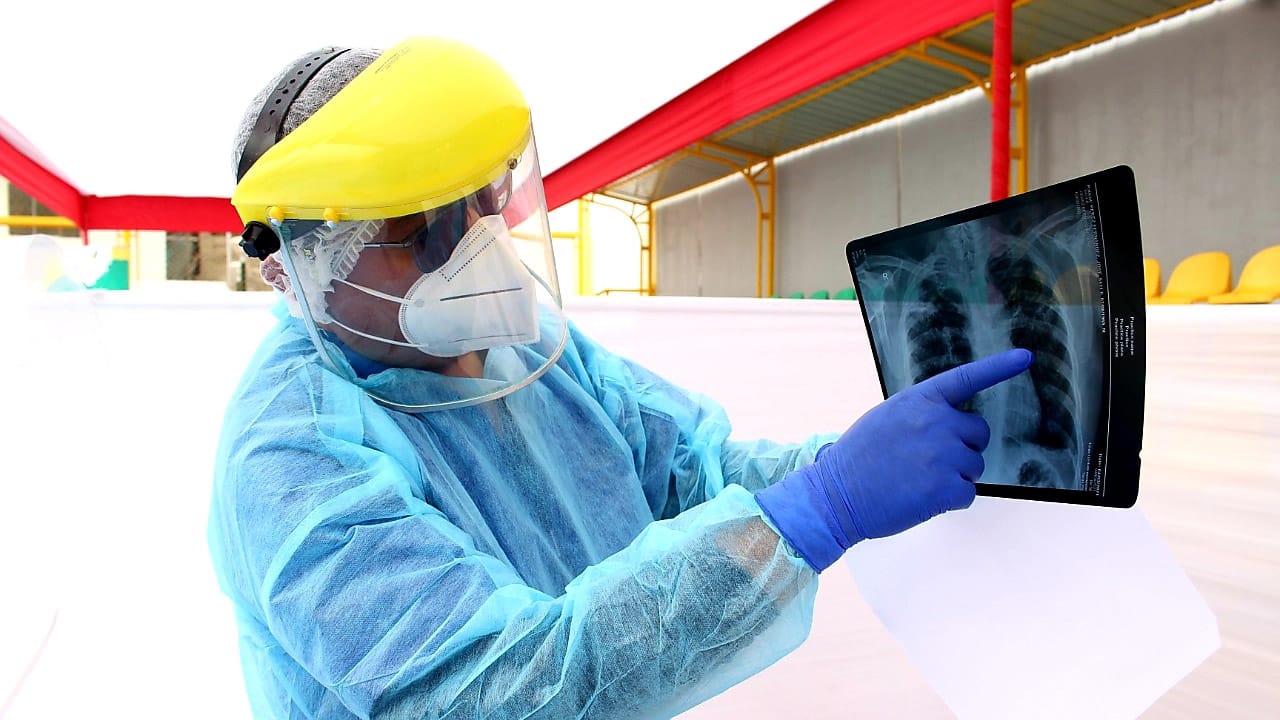 Minsa realiza diagnóstico oportuno y descarte de tuberculosis en Cieneguilla