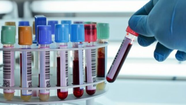 Imagen referencial de tubos hematológicos en el laboratorio