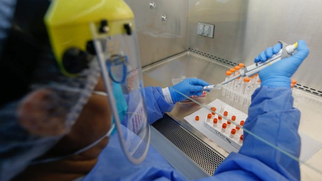 El Perú cuenta con suficientes pruebas para detectar la COVID-19