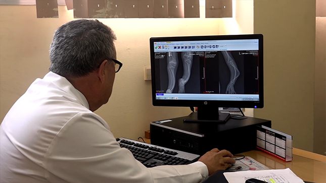 Foto de un médico viendo la radiografía de los huesos deformados por  una enfermedad rara