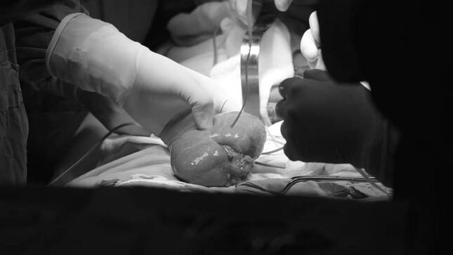 Tres donantes de órganos y tejidos de Arequipa y Piura logran salvar la vida de nueve personas