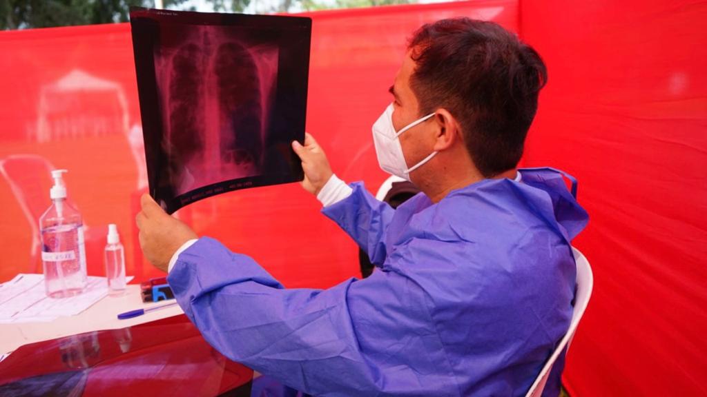 Lima Este: Más de 2400 personas recibieron atención contra la tuberculosis