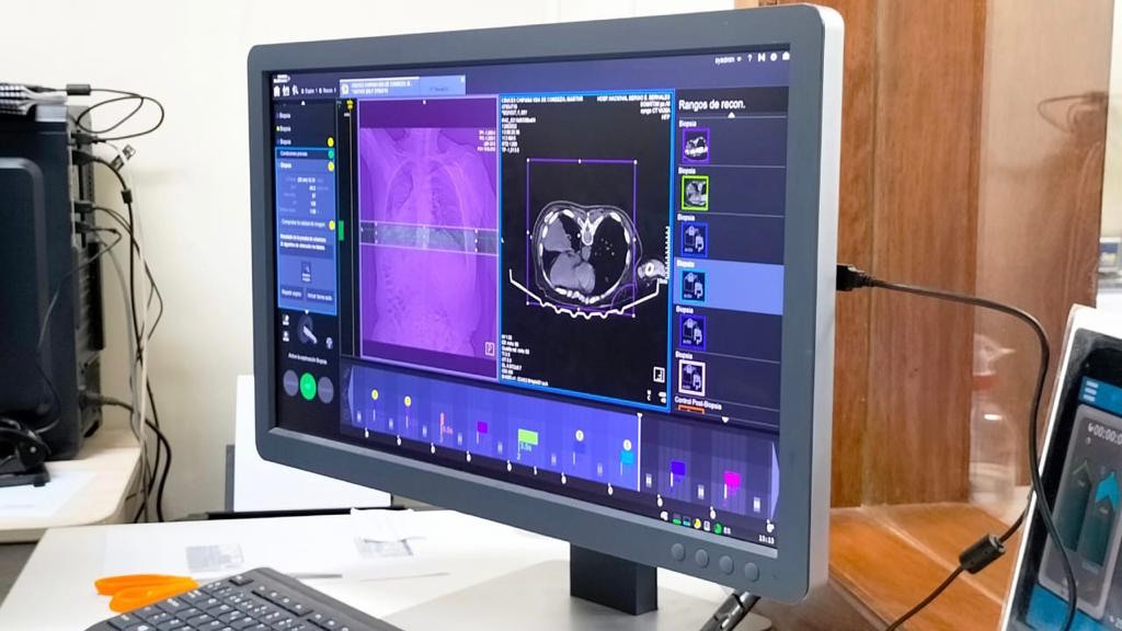Hospital Sergio Bernales cuenta con moderno tomógrafo para pacientes que sufran alguna lesión pulmonar
