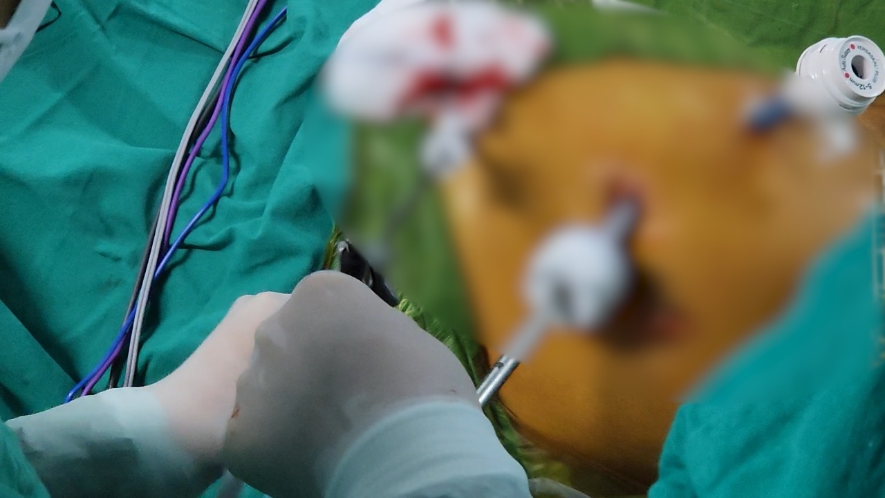 Hospital Loayza realiza exitoso trasplante renal de padre a hija-