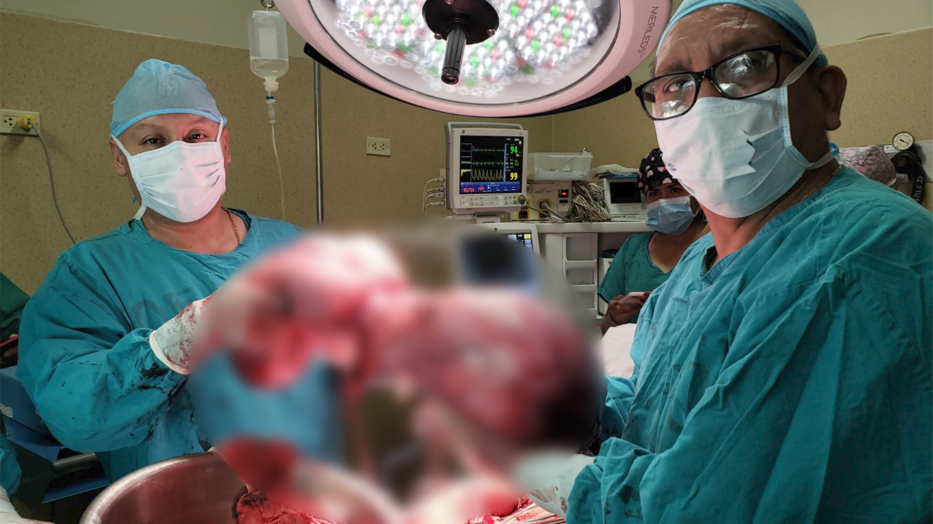 Cirujanos del Hospital Loayza logran remover tumor gigante de mujer proveniente de Tumbes