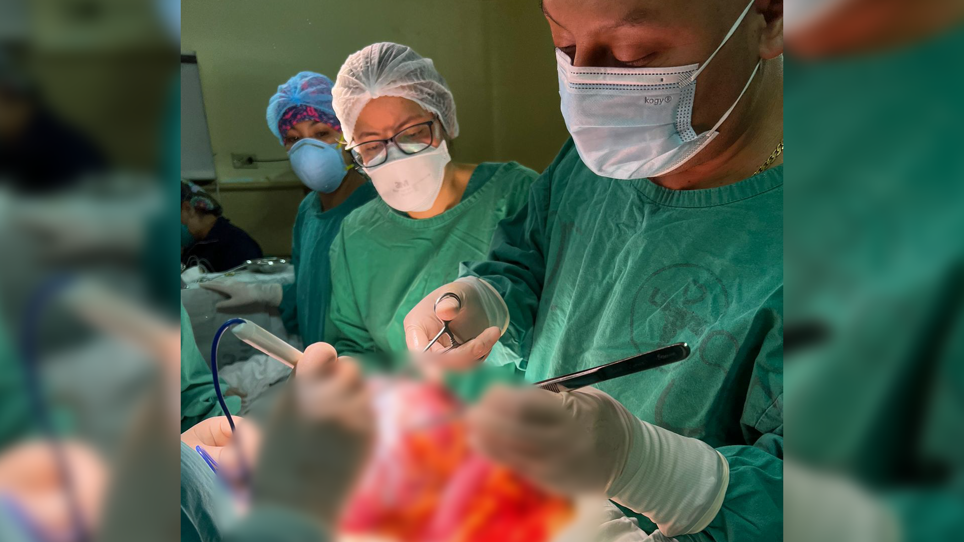 Cirujanos del Hospital Loayza logran remover tumor gigante de mujer proveniente de Tumbes