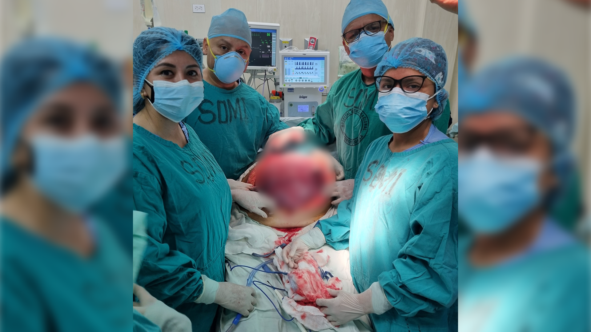 Cirujanos del Hospital Loayza logran remover tumor gigante de mujer proveniente de Tumbes