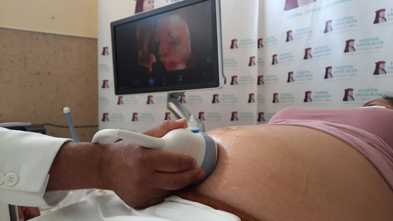 Hospital Santa Rosa Adquiere nuevo Ecógrafo 4D