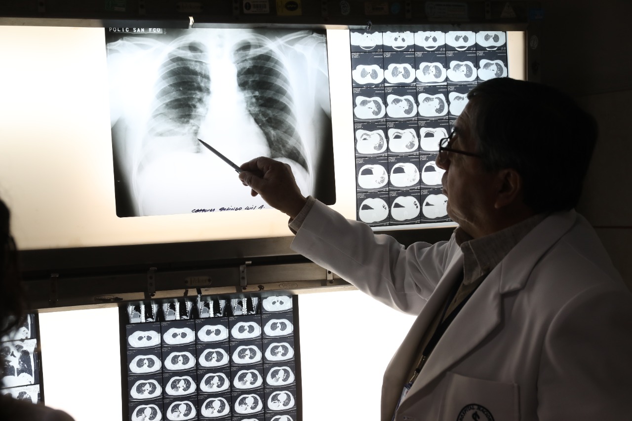 Día Mundial del Cáncer de Pulmón un diagnóstico oportuno puede ayudar a salvar vidas