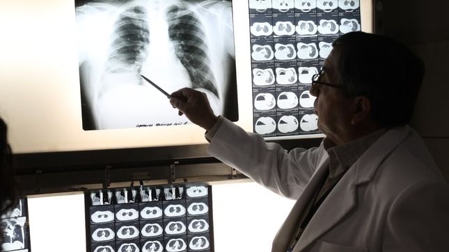 Día Mundial del Cáncer de Pulmón un diagnóstico oportuno puede ayudar a salvar vidas