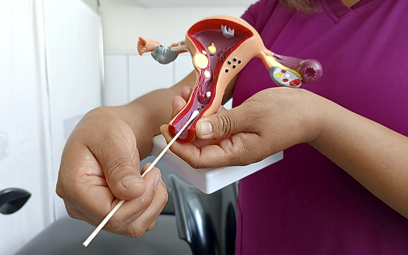 Foto 1 de Mujeres podrán recibir el tratamiento oportuno al VPH en los establecimientos de salud de la Diris Lima Centro