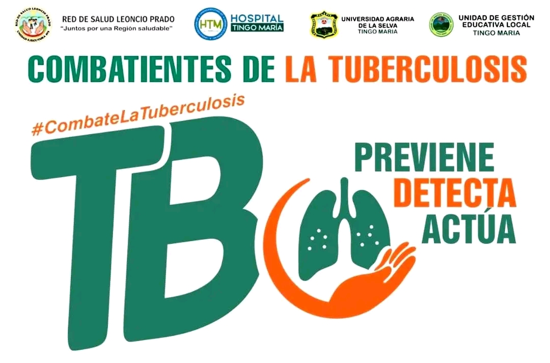 Concurso TBC