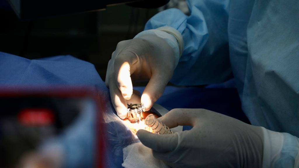 Minsa: más de 34 400 pacientes fueron operados tras iniciado el plan de desembalse quirúrgico en el Perú