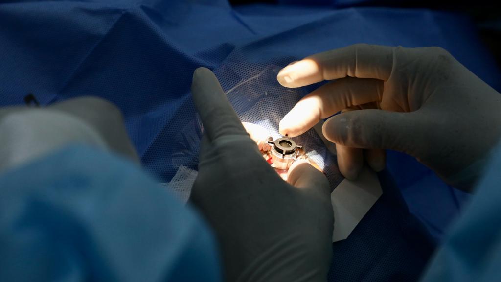 Minsa destinará S/ 20 millones adicionales para continuar con intervenciones quirúrgicas en todo el país