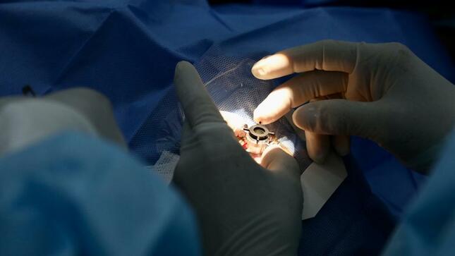 Minsa destinará S/ 20 millones adicionales para continuar con intervenciones quirúrgicas en todo el país