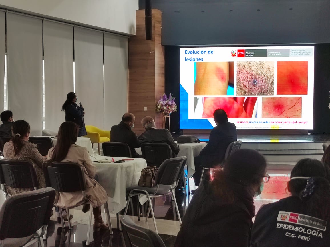 1 de Viruela del Mono: Diris Lima Centro realiza capacitación a personal de salud