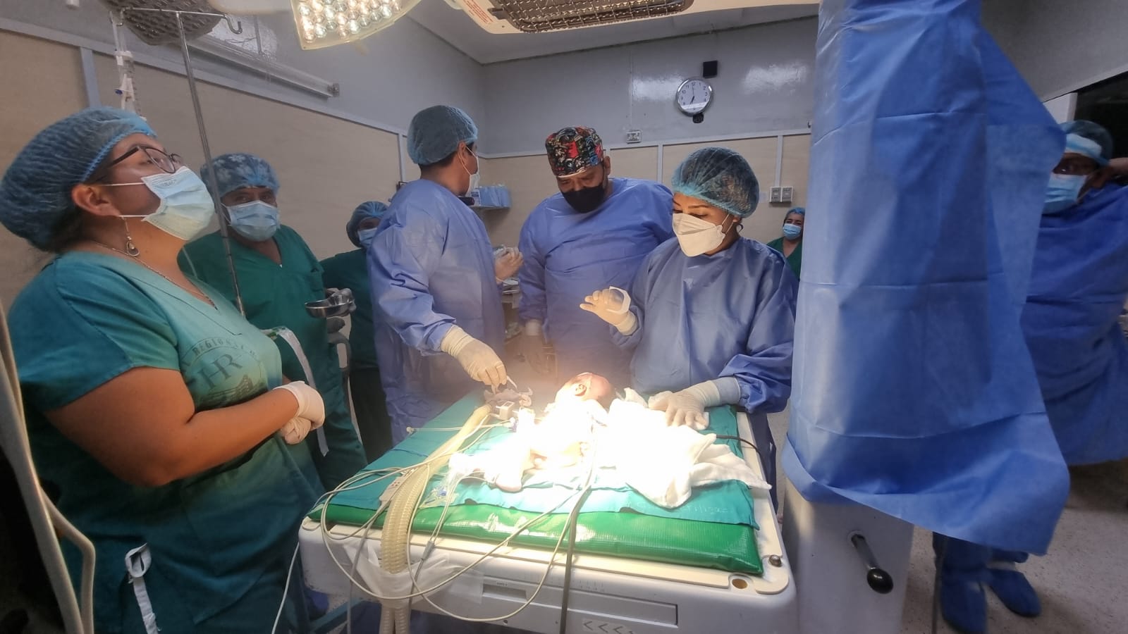 Especialistas del hospital JAMO instalan válvula de drenaje a paciente neonato con hidrocefalia congénita