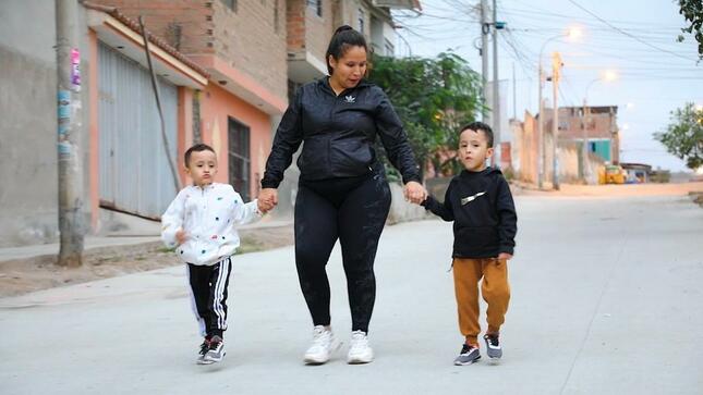 Siameses que fueron separados con éxito cumplirán 5 años gracias a operación que les salvó la vida 