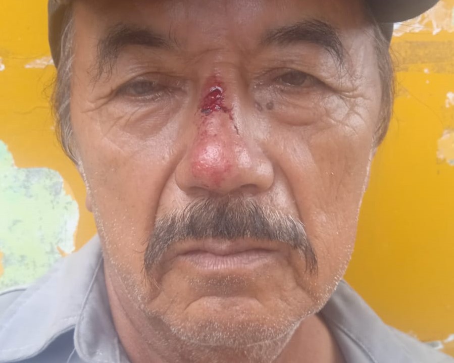 Obrero De Limpieza Pública Sufre Agresión Tras Llamar La Atención A Personas Que Arrojan Basura