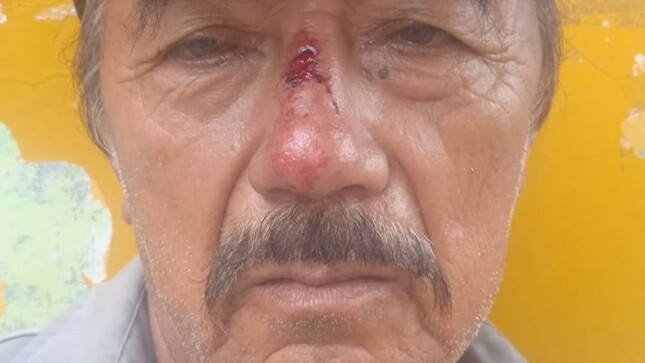 Obrero De Limpieza Pública Sufre Agresión Tras Llamar La Atención A Personas Que Arrojan Basura