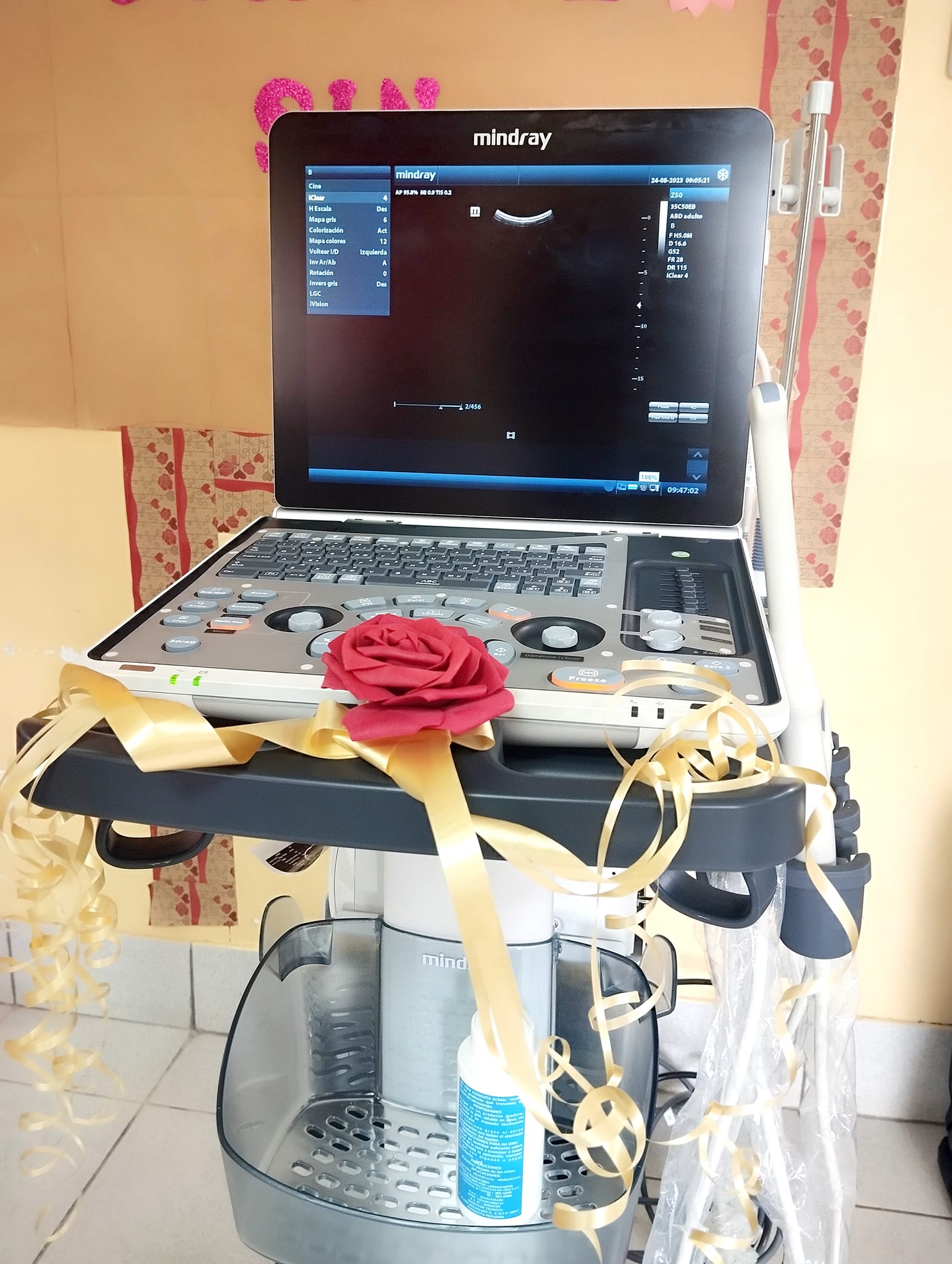 Juan Díaz Amado, entregó un ecógrafo portátil ginecológico 3D, que será para las atenciones en el servicio de Emergencia