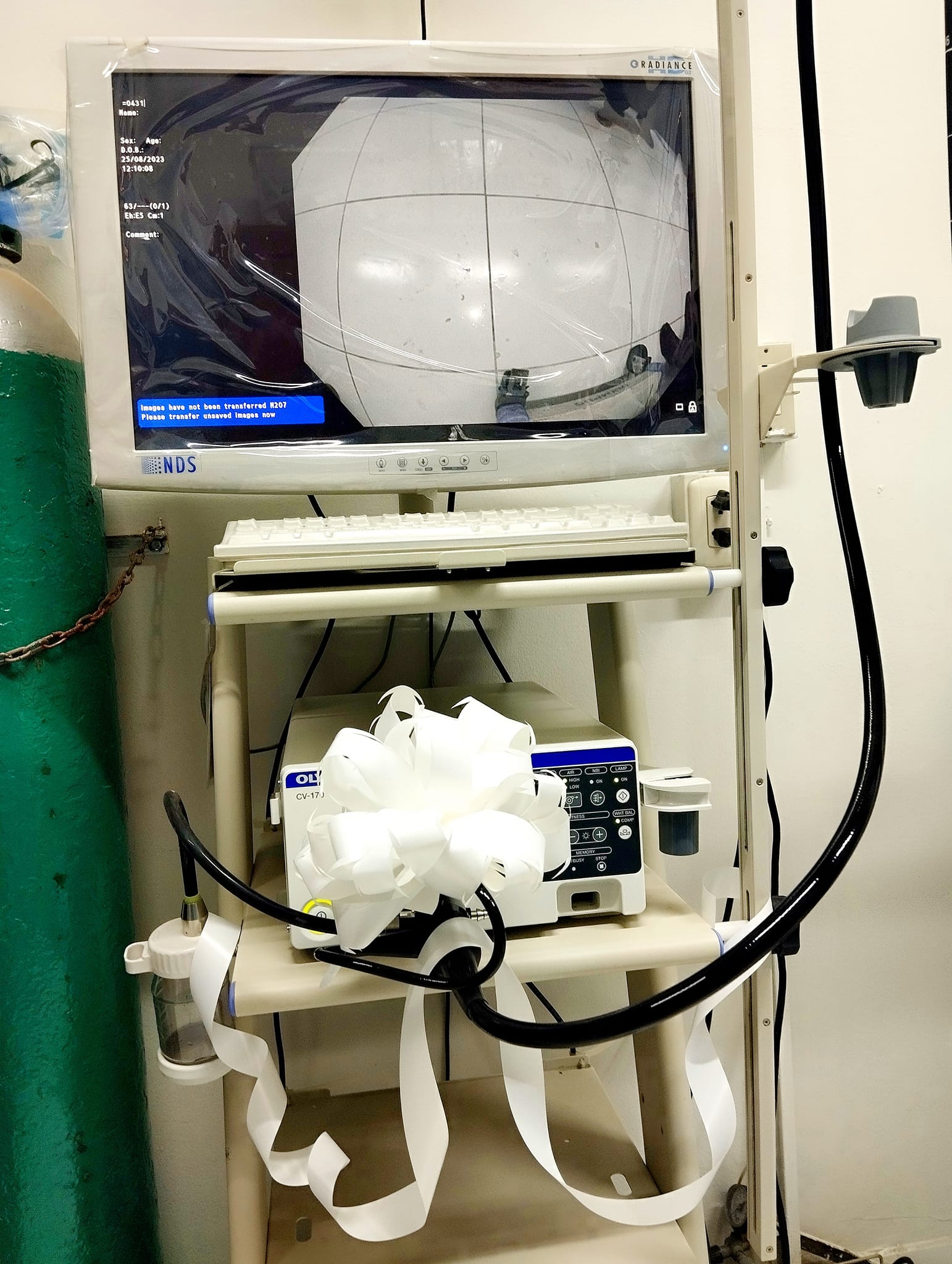 VideoGastroscopio 01