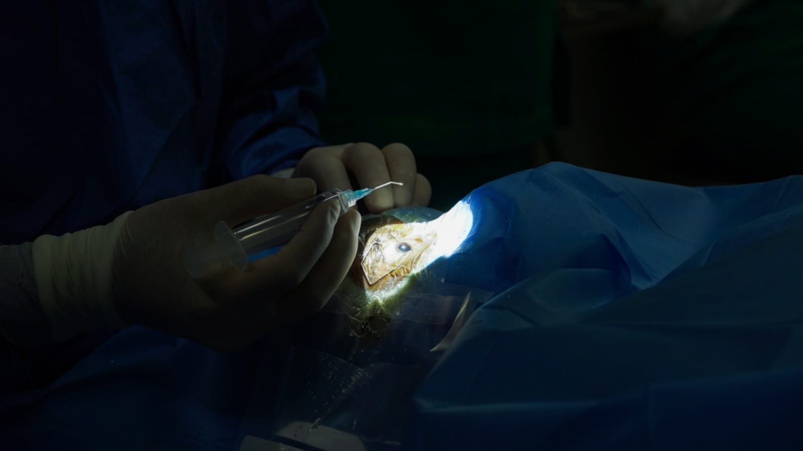Minsa: adultos mayores del Inabif recuperarán la visión tras ser operados de cataratas en el INO