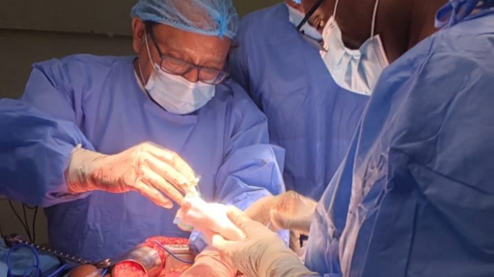 INEN capacita a médicos de África en el tratamiento quirúrgico de cáncer de hígado