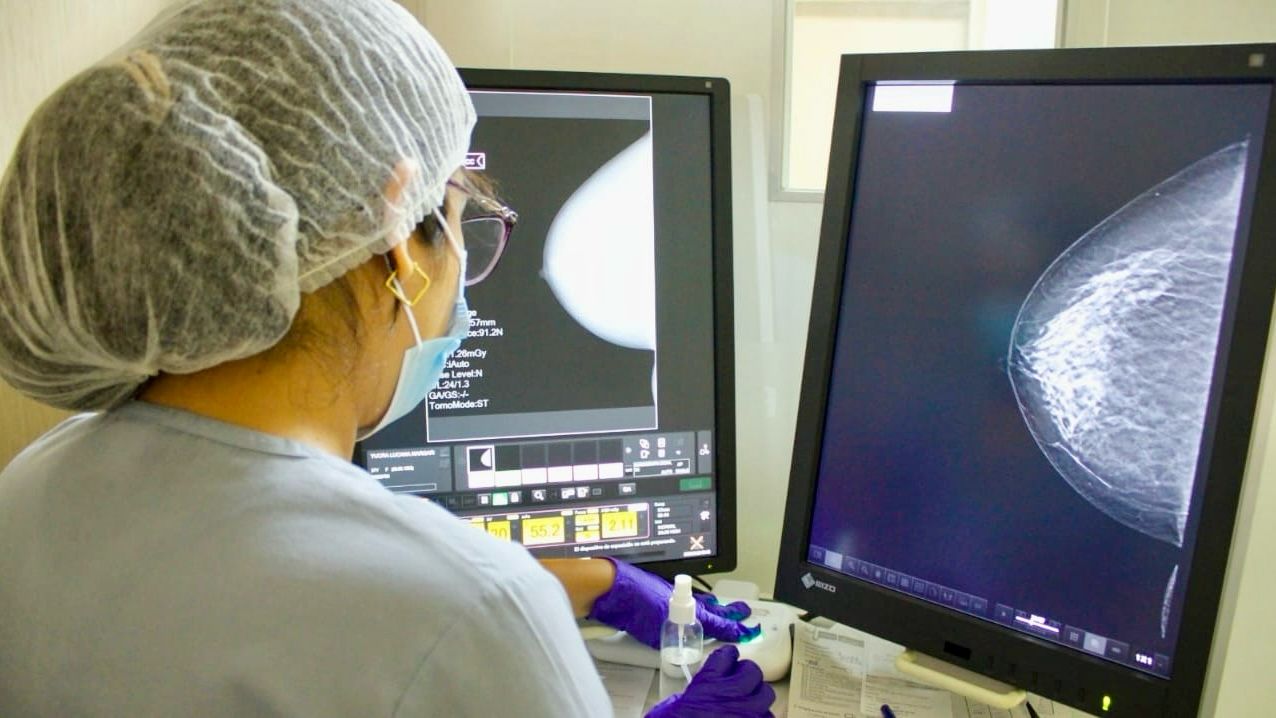Hospital Santa Rosa realizará campaña de prevención y despistaje del cáncer de mama