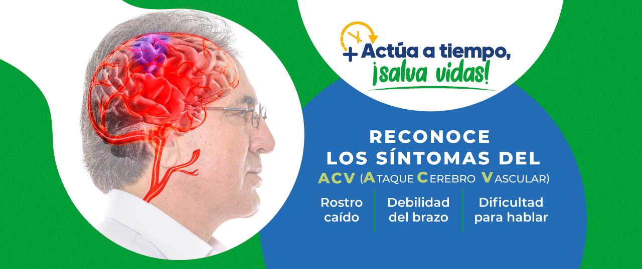 SINDROME DE ATAQUE VASCULAR