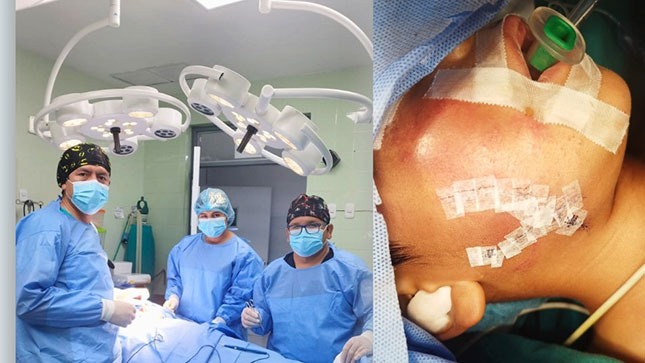 Médicos del Hospital Sub Regional de Andahuaylas reconstruyen rostro de menor que fue mordido por un cerdo