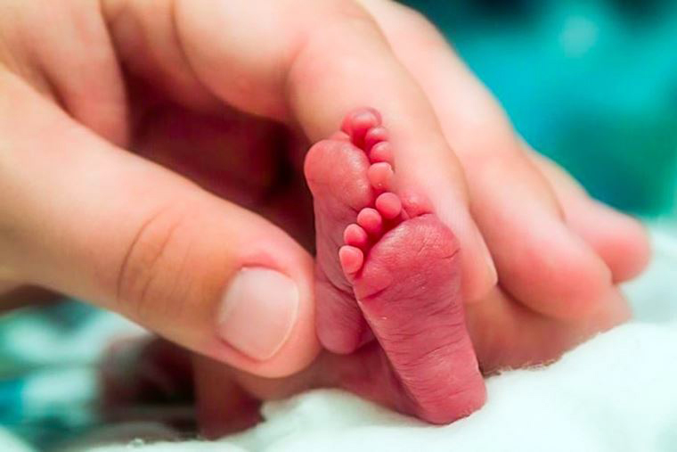 6 % del total de recién nacidos en Lambayeque son prematuros