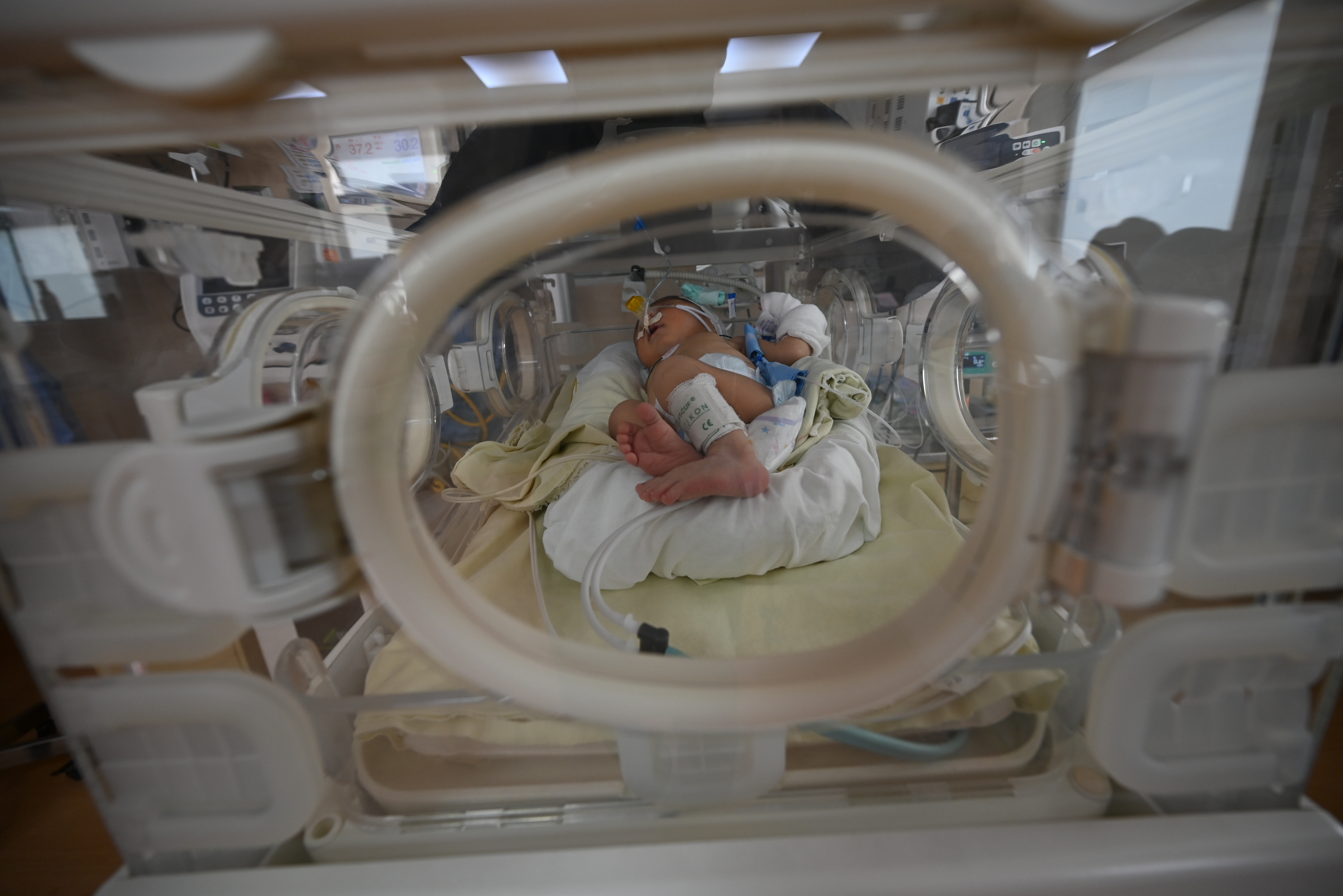 El INSN brinda atención integral de calidad a prematuros de todo el país