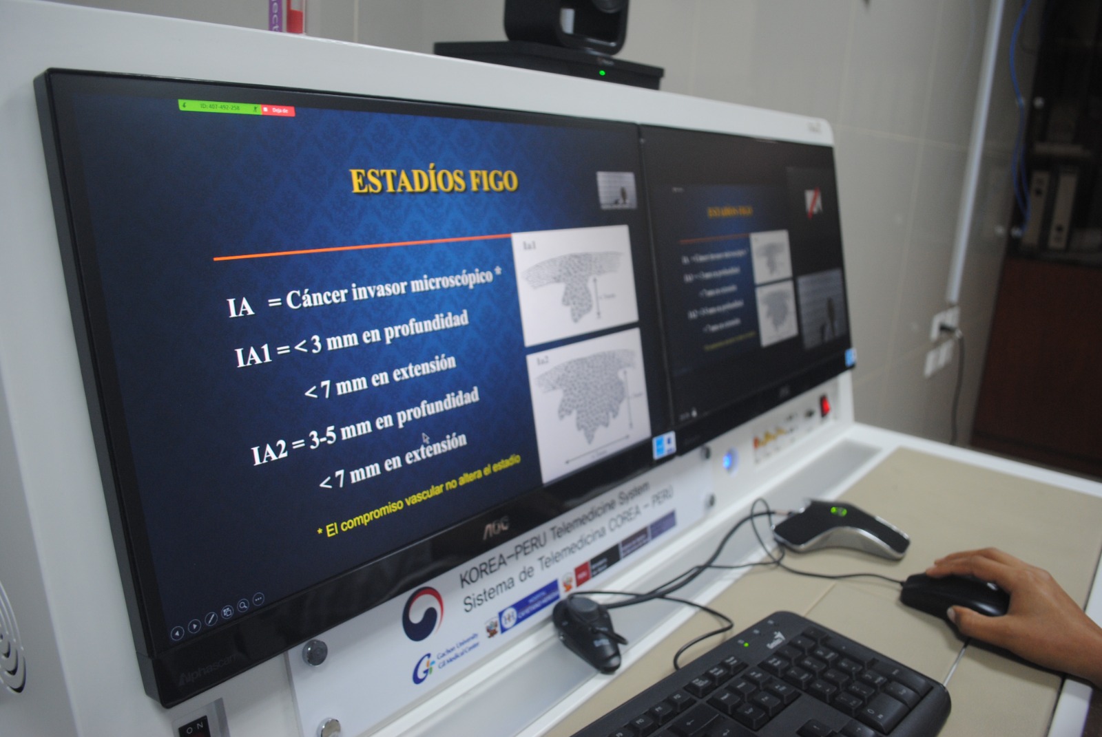 Telemedicina 2 HNCH