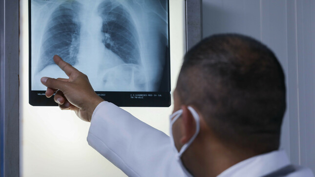 EsSalud alerta incremento de casos de tuberculosis y exhorta a los pacientes a culminar tratamiento