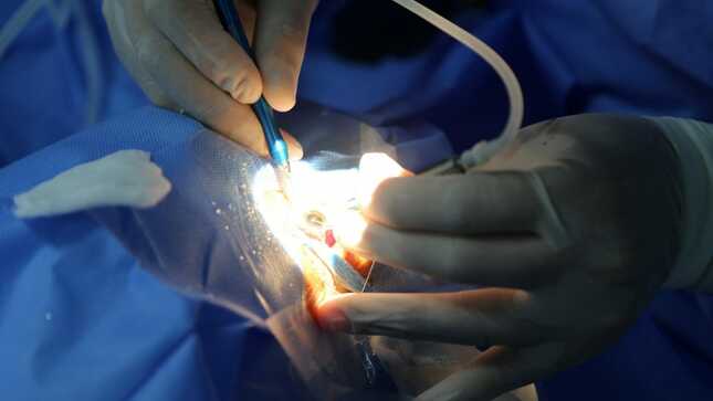 Más de 70 adultos mayores de Cutervo se beneficiarán con cirugías gratuitas de catarata