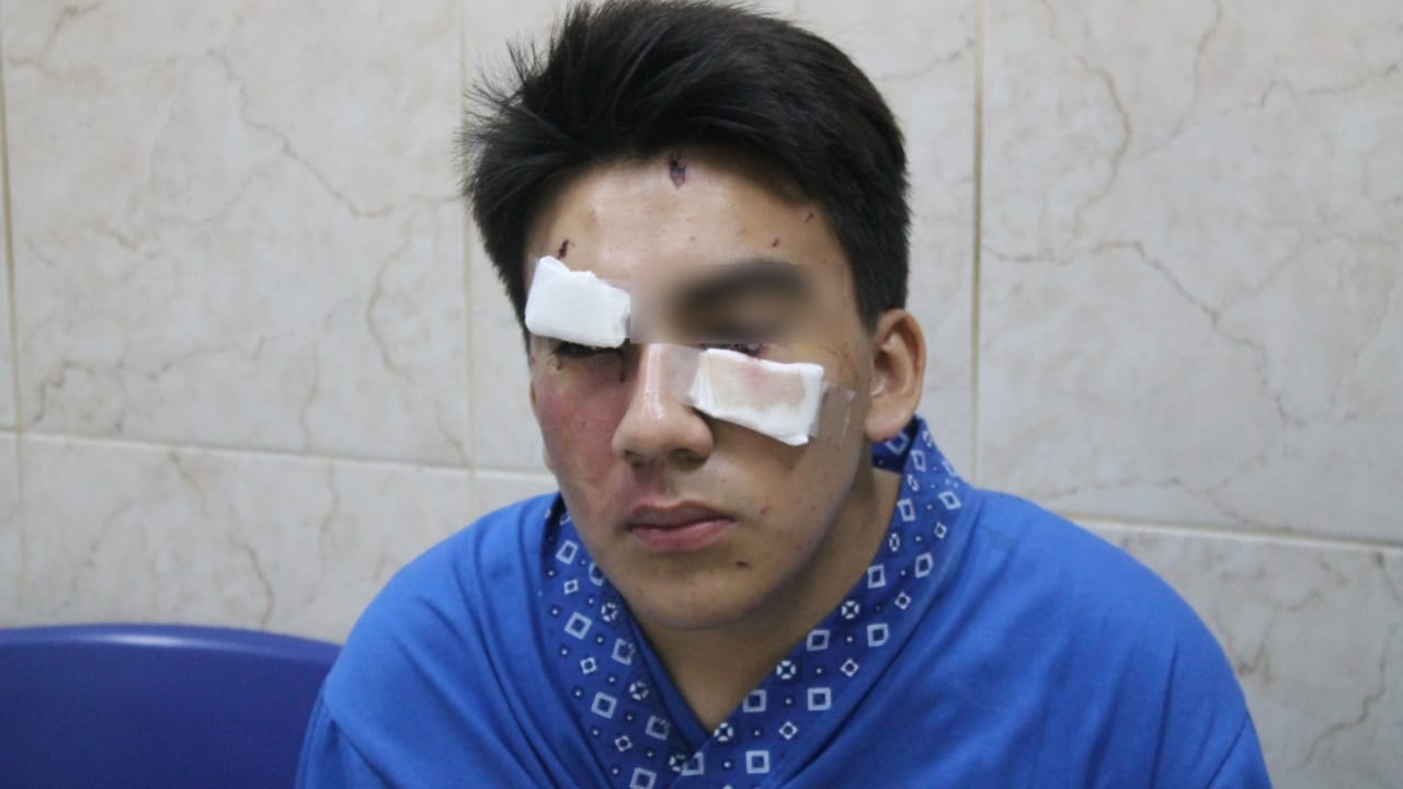 Especialistas del INO advierten sobre accidentes oculares en fiestas navideñas