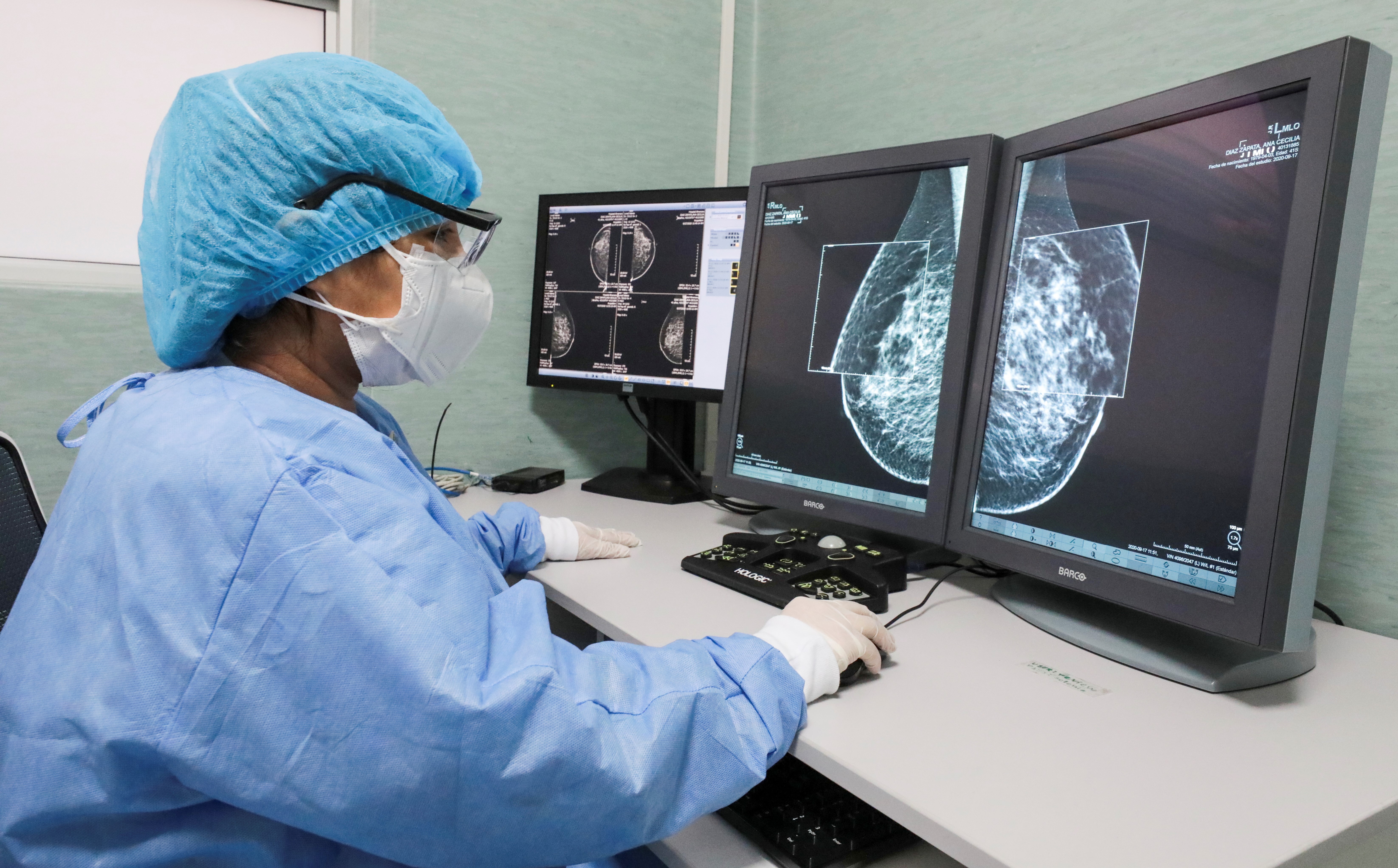EsSalud: más de 150 mil radiologías intervencionistas salvan vidas en el hospital Almenara