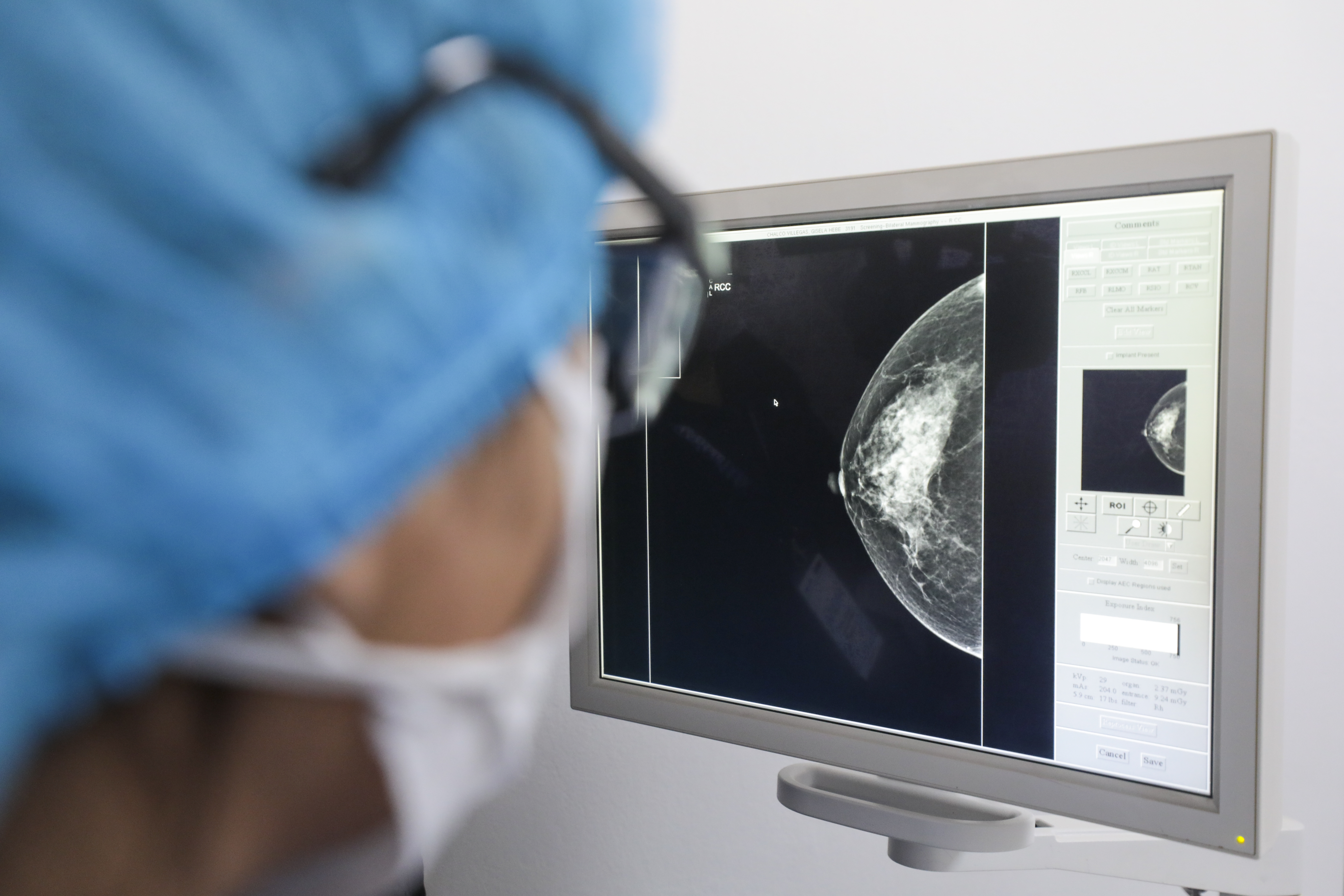 EsSalud: más de 150 mil radiologías intervencionistas salvan vidas en el hospital Almenara