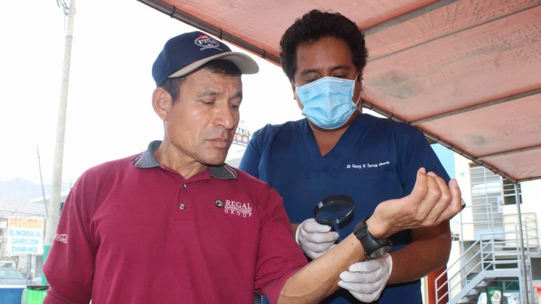 Radiación solar en aumento Minsa alerta sobre la escalada del cáncer de piel en el país-