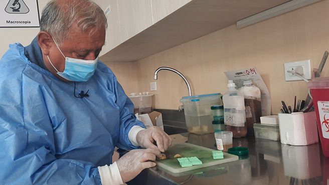 Hospital Santa Rosa fortalece innovación médica y tecnología avanzada para mejorar la atención oncológica
