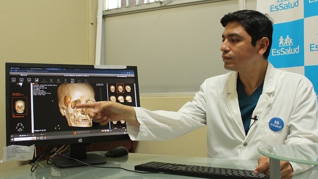EsSalud salva vida de abuela gracias a exitosa extracción de tumor y reconstrucción de cráneo 