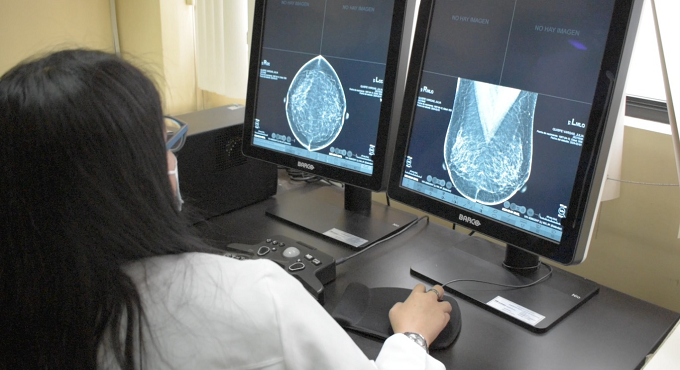 Aseguradas se beneficiarán con chequeos preventivos. Asimismo, para febrero y marzo se prevé realizar 500 exámenes más.