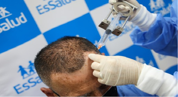 EsSalud: Hospital Rebagliati realiza innovador procedimiento para determinar si un paciente tiene o no cáncer